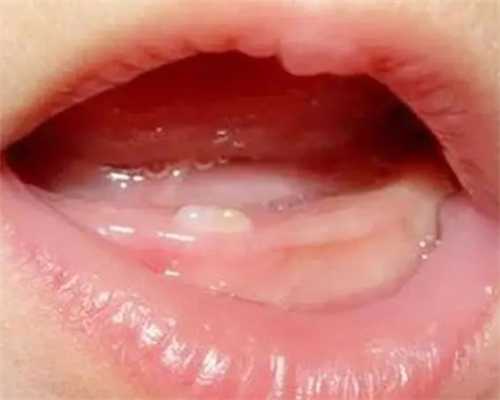 染色体多态性试管婴儿，染色体多态性适合做几代试管